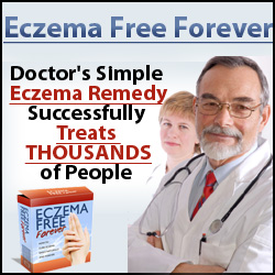 Beat Eczema for Good:  Is It Possible?